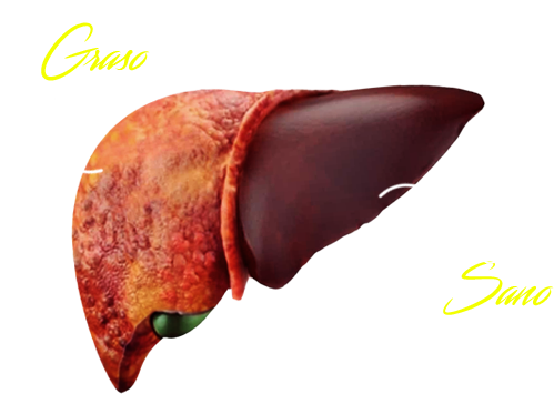 Higado graso vs hígado sano